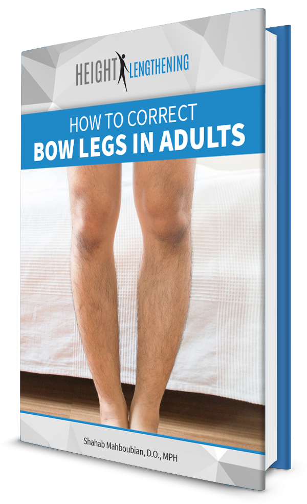How to Correct Bow Legs in Adults ebook download