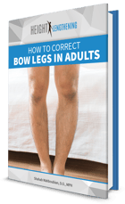 how-to-correct-bow-legs-in-adults-ebook-graphic